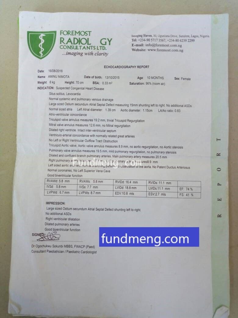 2 year old baby Ola Aminu has a hole in her heart, she needs your help to live