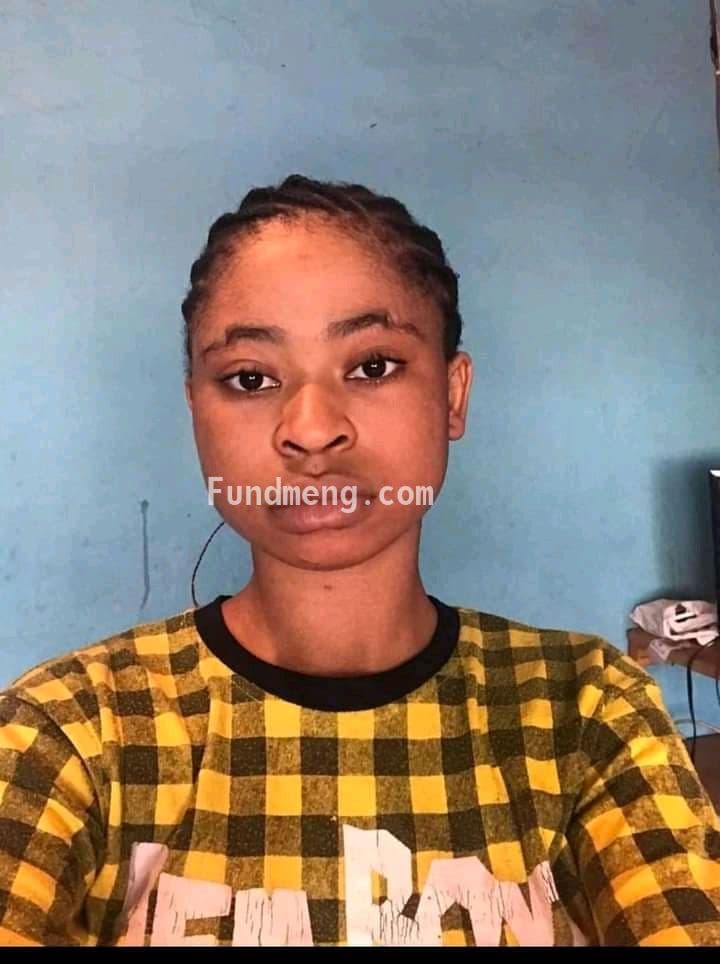 I need help, My name is debola, I was born with facial deformalities which made me different from my siblings and everyone else, Please I need funds to pay for my head correction surgery (jaw, eyebrows and head scalp) A part of my face is swollen than the