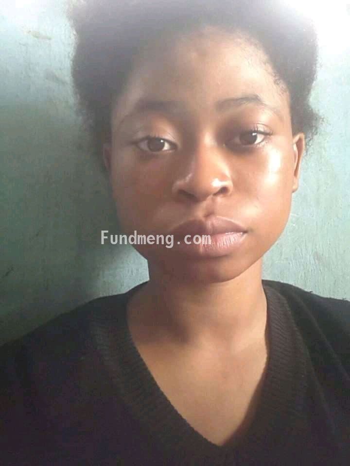 I need help, My name is debola, I was born with facial deformalities which made me different from my siblings and everyone else, Please I need funds to pay for my head correction surgery (jaw, eyebrows and head scalp) A part of my face is swollen than the