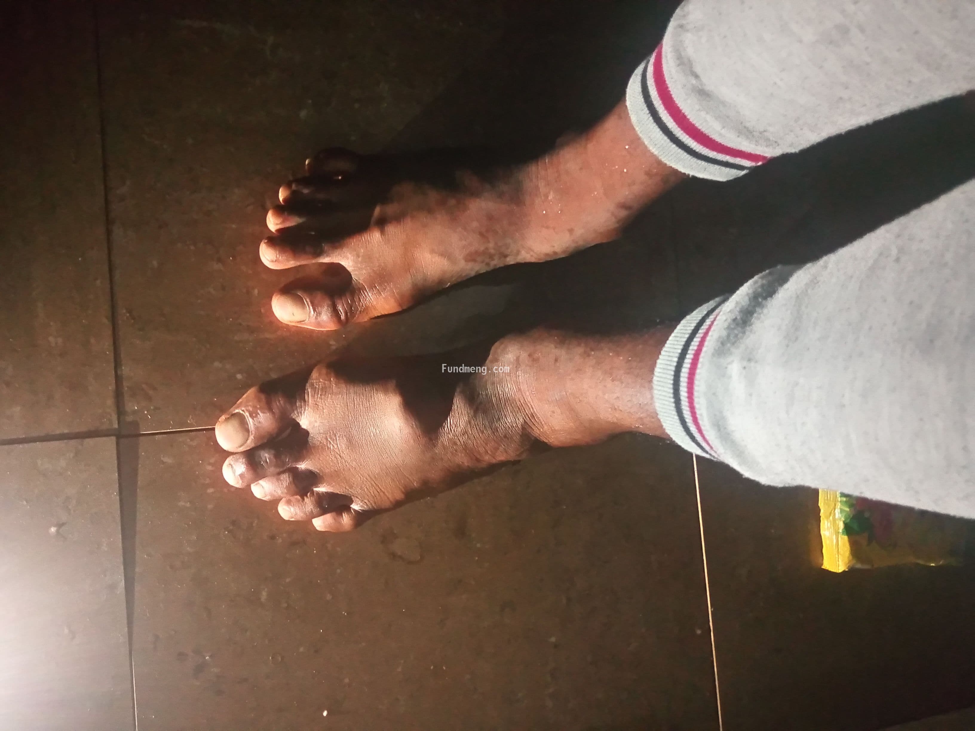 My name is Ebube Ogunedo, please help me kick tumor