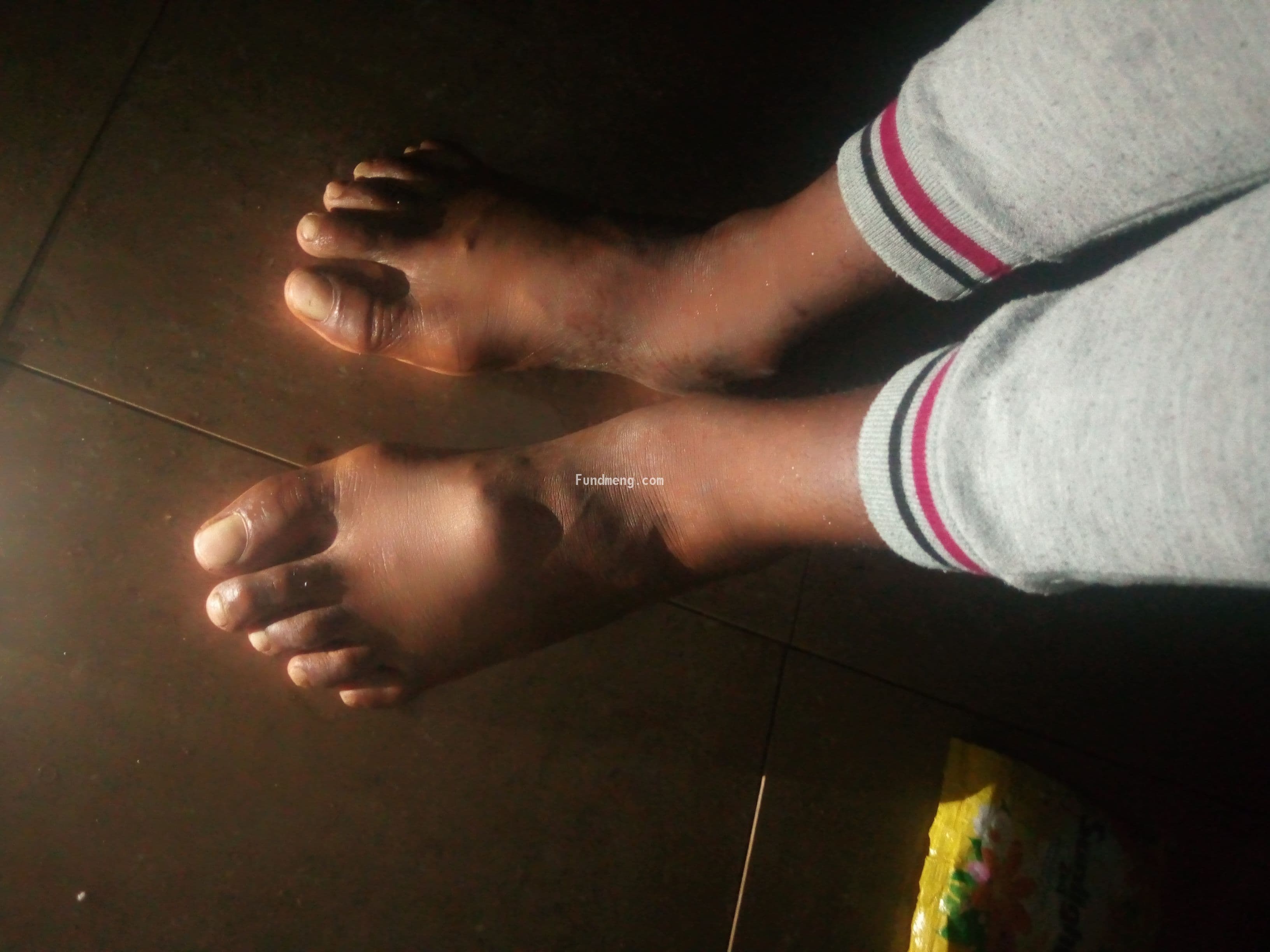 My name is Ebube Ogunedo, please help me kick tumor