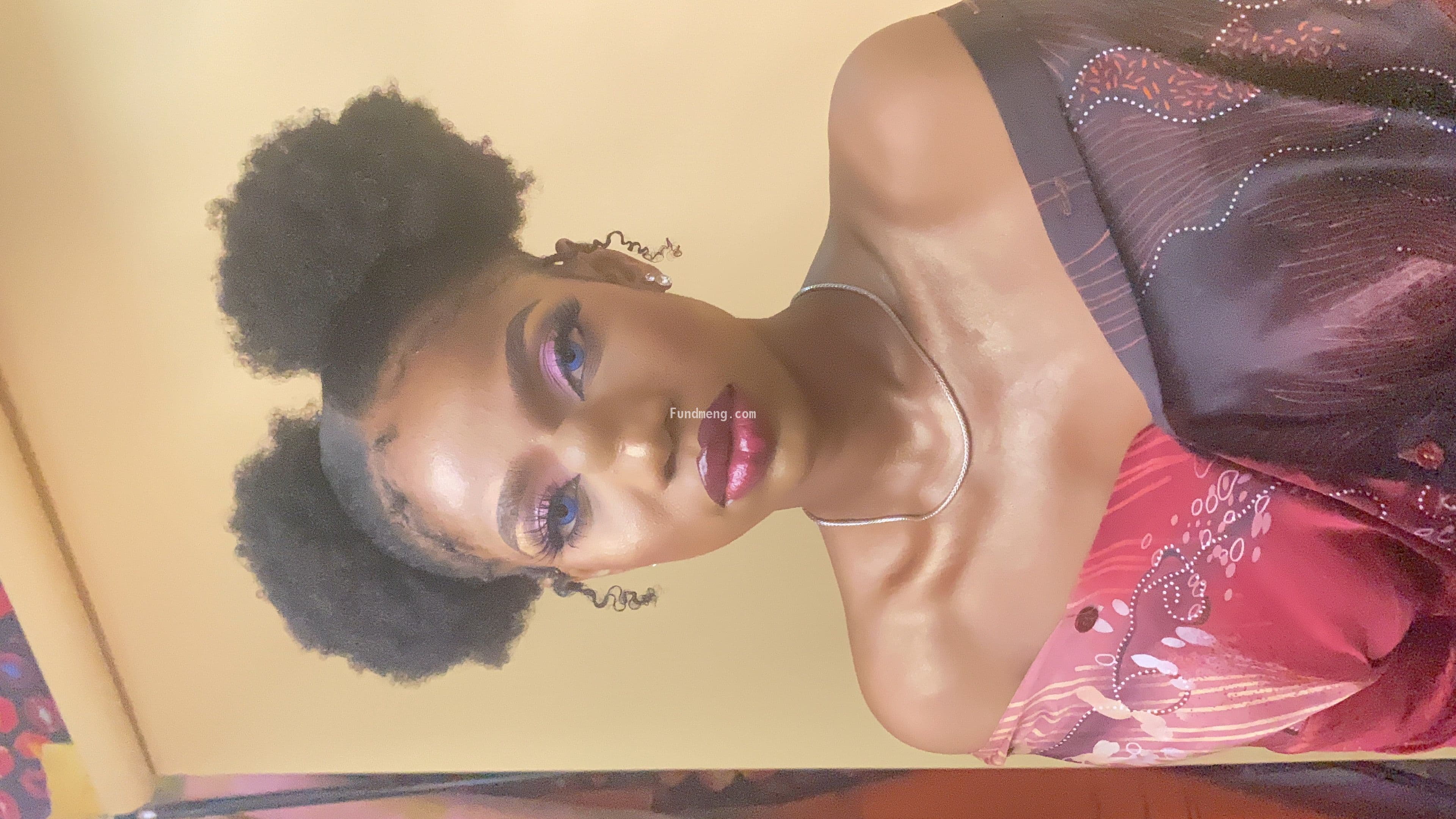 Help Chizi Anele proceed with a Lipoma Surgery