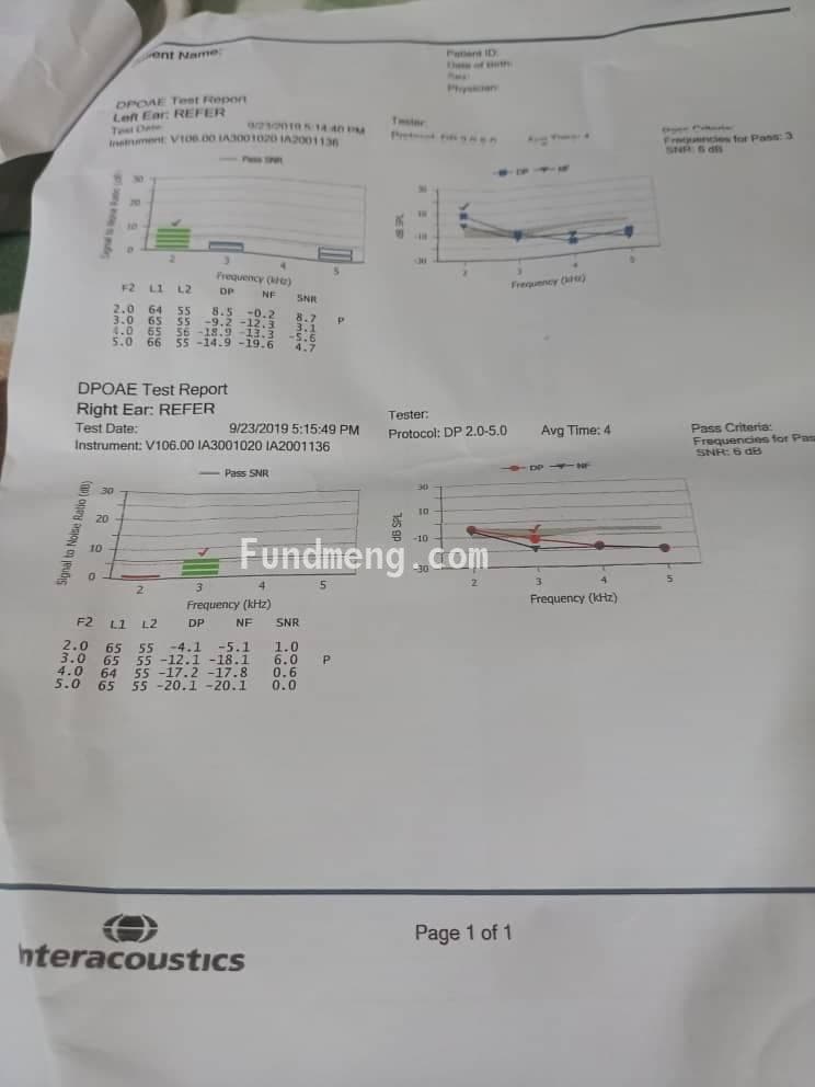 Asa needs a Cochlear Implant via Surgery