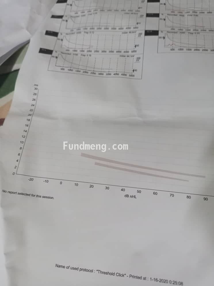 Asa needs a Cochlear Implant via Surgery