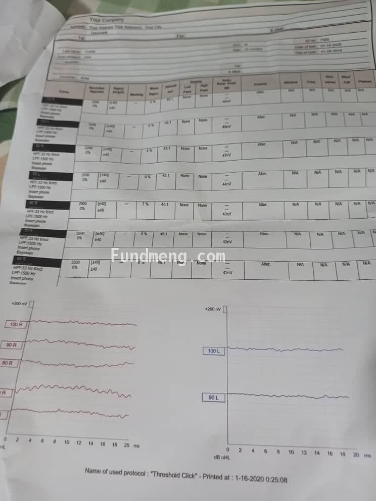 Asa needs a Cochlear Implant via Surgery
