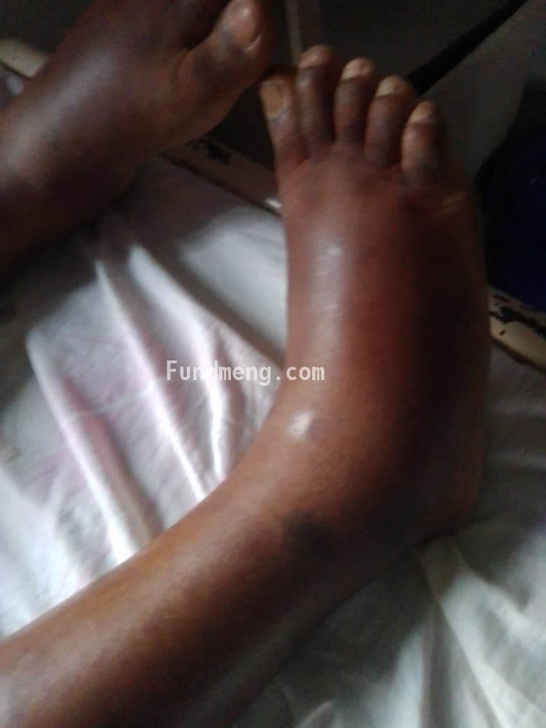 Save Samson Oluseye from heart failure diseases