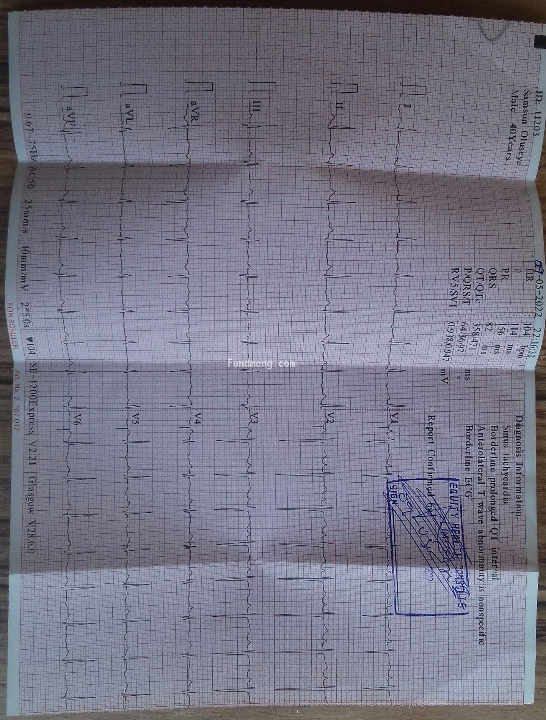 Save Samson Oluseye from heart failure diseases