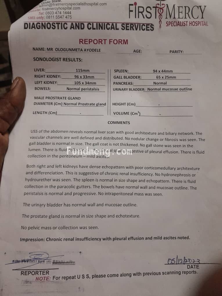 Help Ayodele Ologunmeta get a kidney transplant