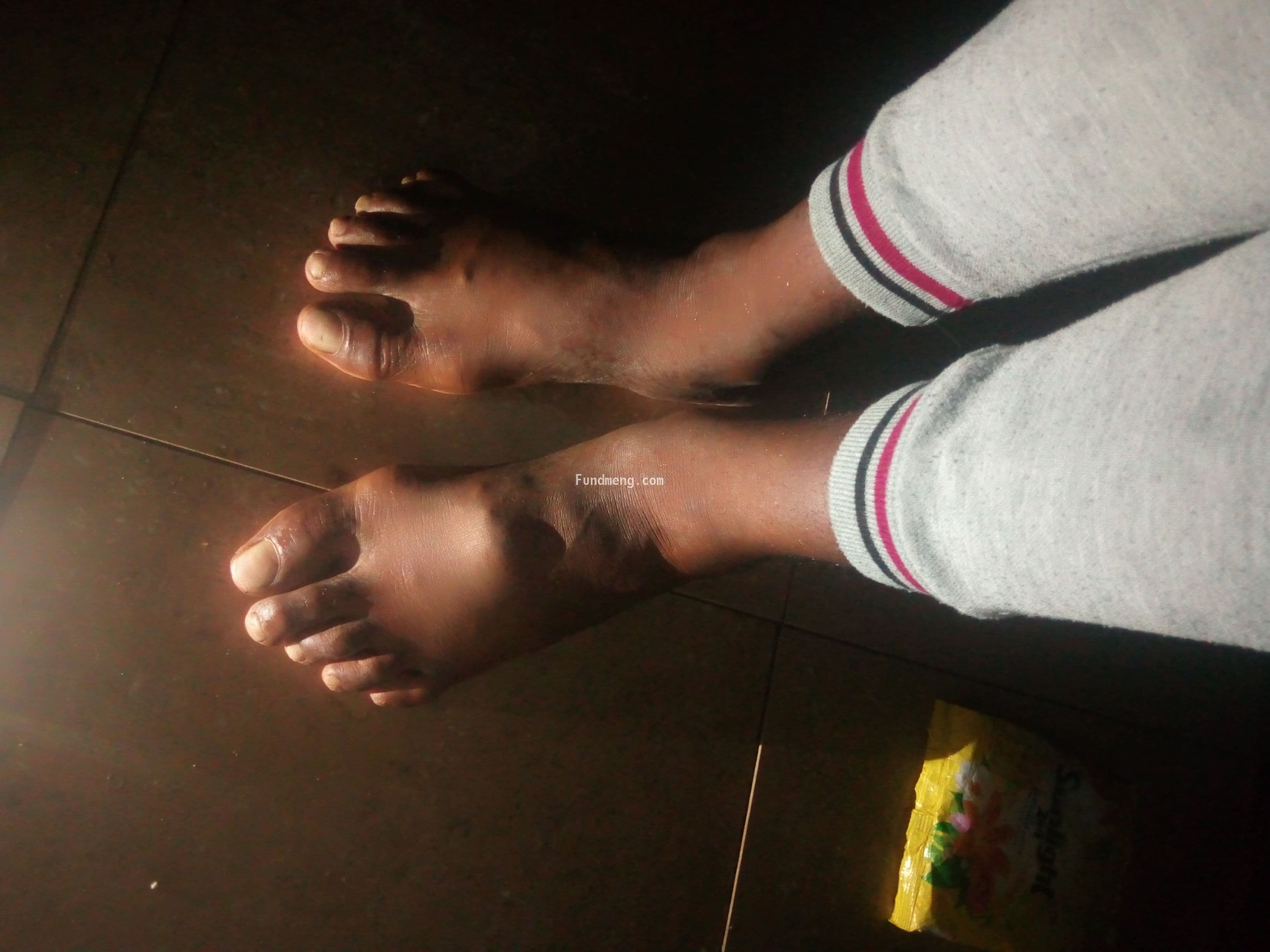 Help Ebube kick tumor