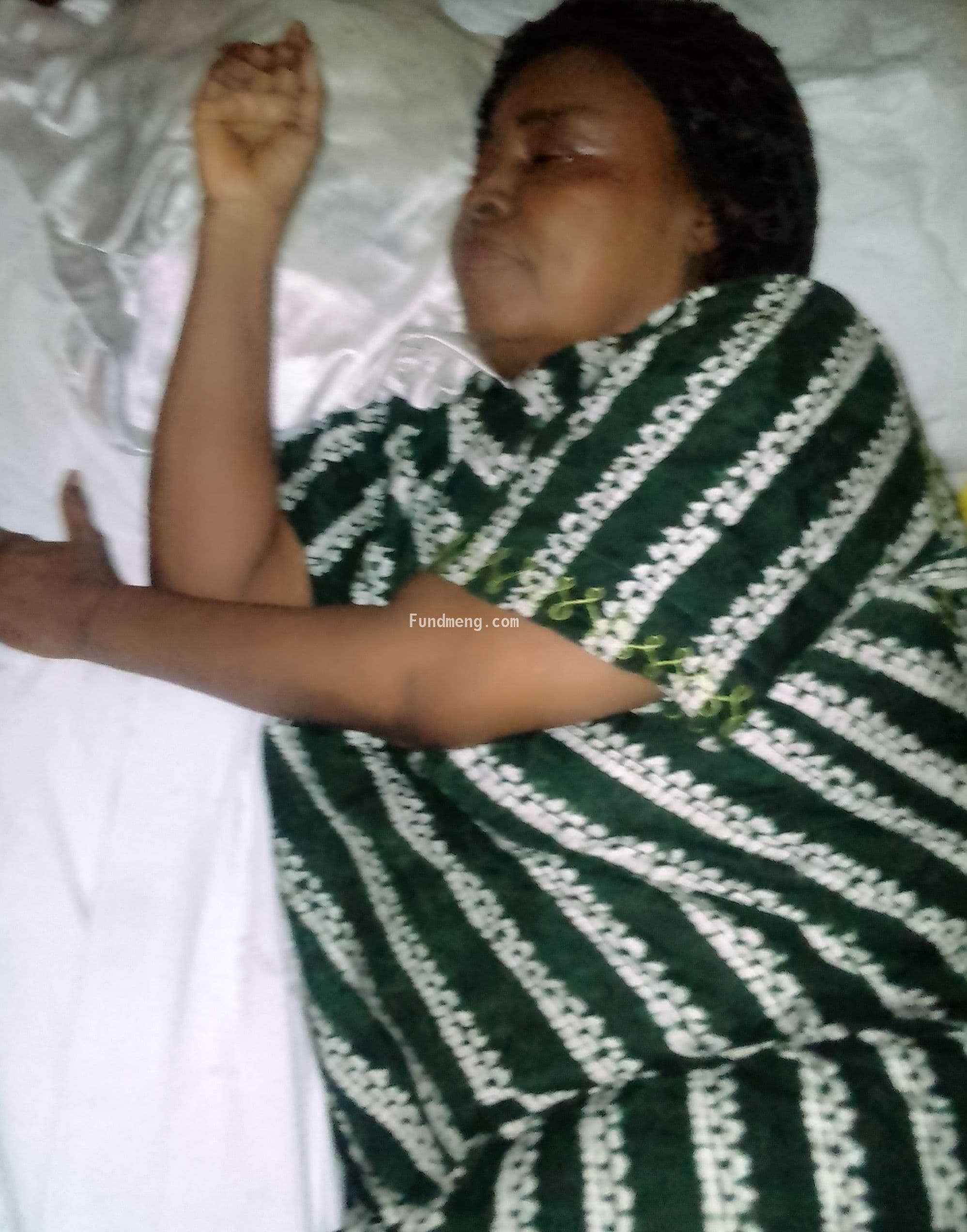 Help "Grace Inyang " overcome seizures and fatal high BP "