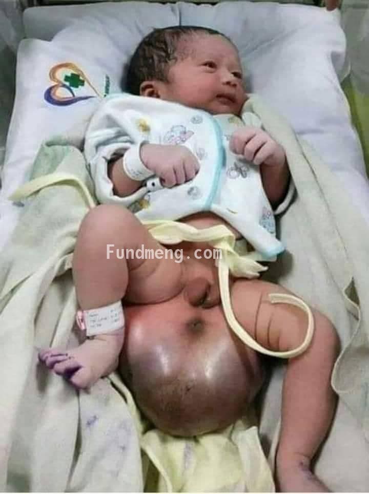 HELP SAVE THE LIFE OF BABY LORDLEADS