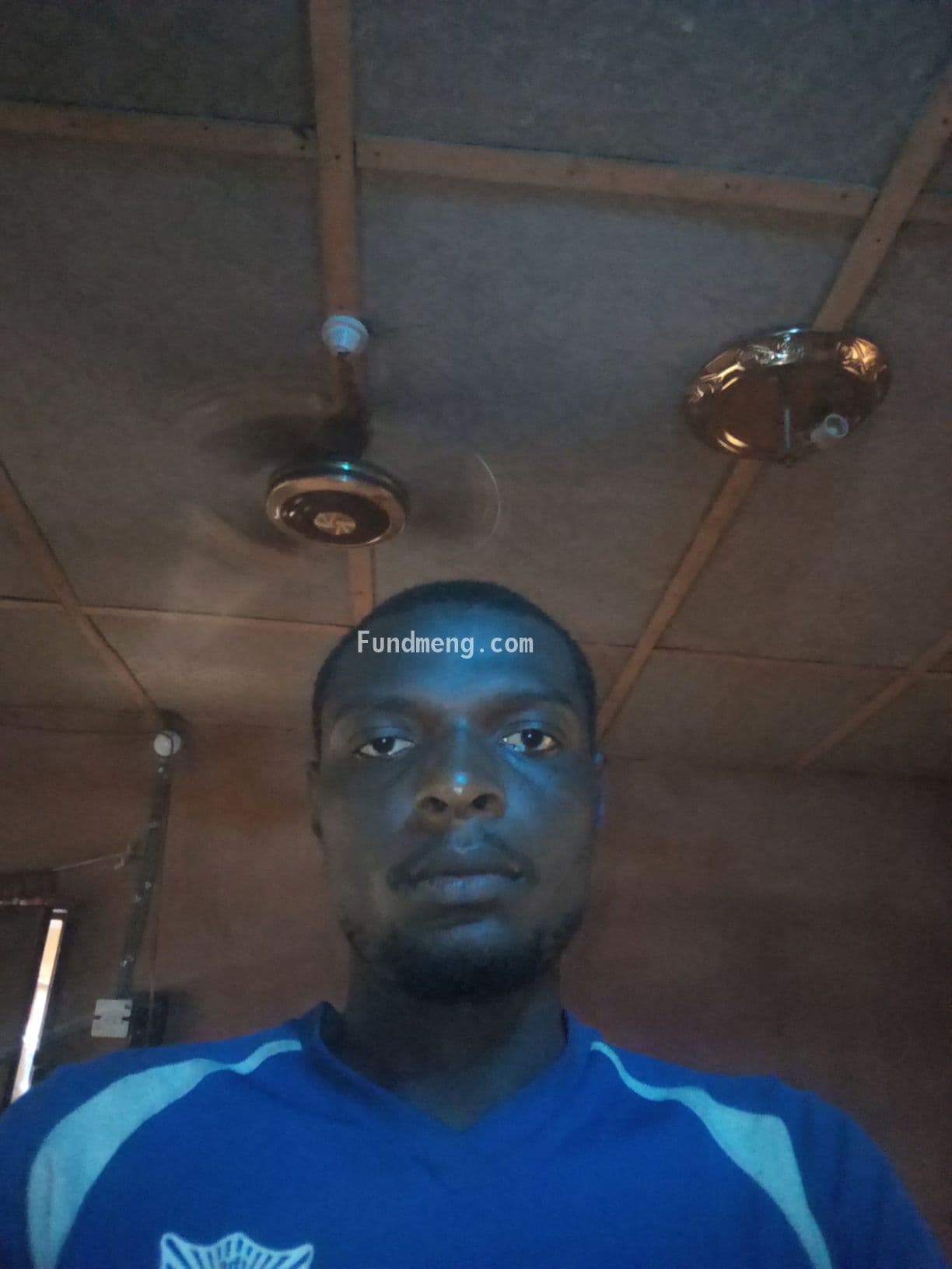 Help Kingsley onah eye sight cure!