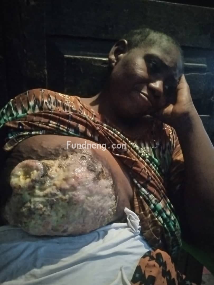 Please Help Mrs Theresa Onunaku to fight breast cancer.