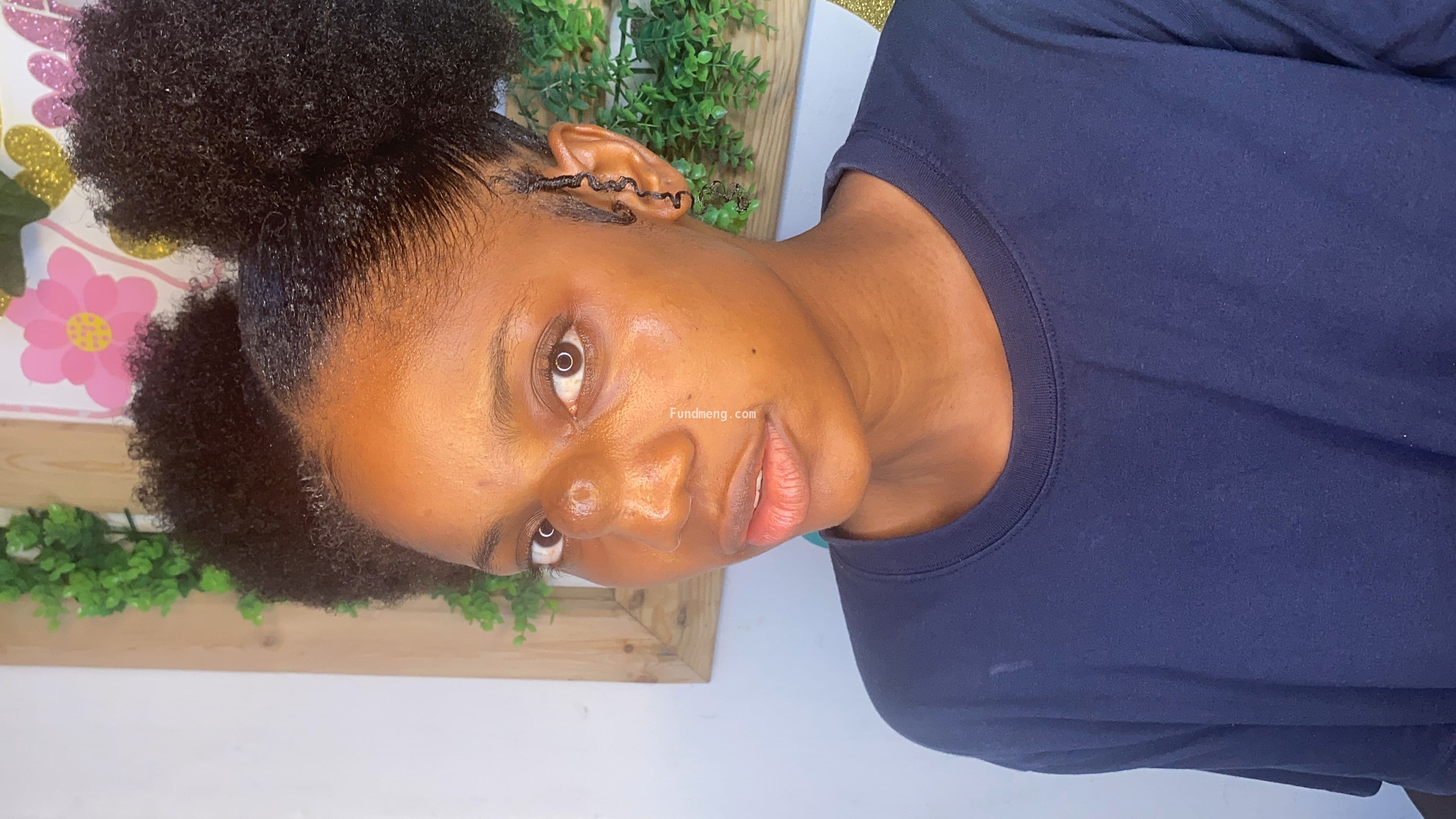 Help Chizi Anele proceed with a Lipoma Surgery