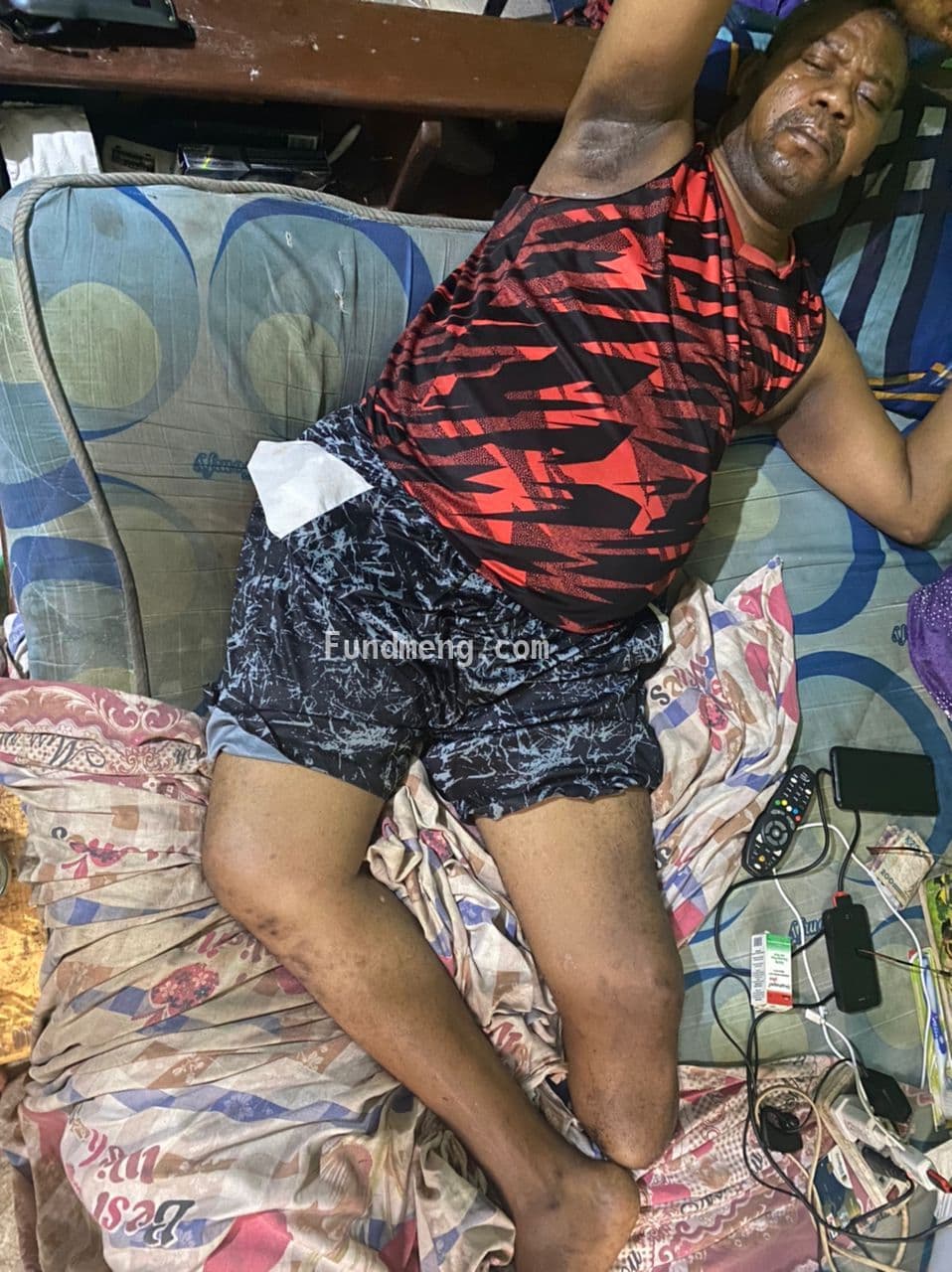 Help Simeon Ugochukwu Walk Again