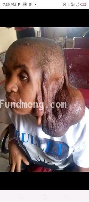 Help Nwake blessing cancer.
