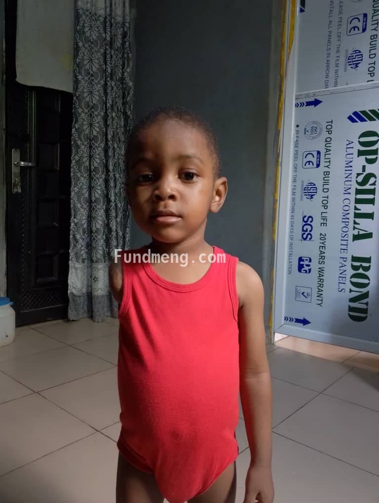 Save Baby Miracle's Hand