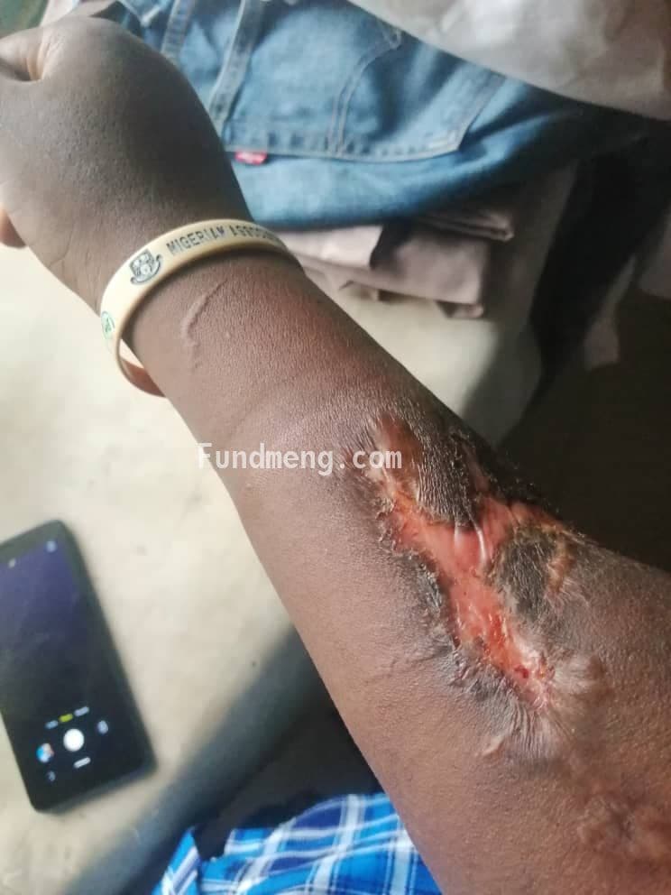 Help with surgical bills for Adegoke Theophilus Bamise