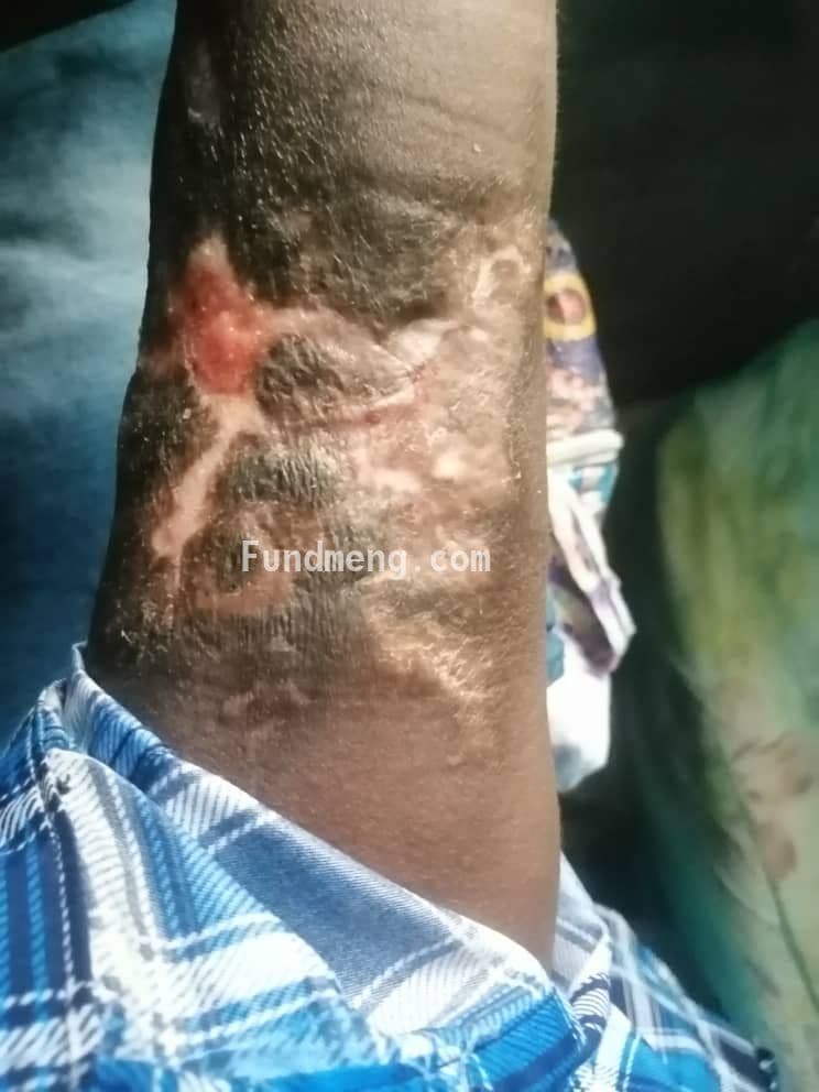 Help with surgical bills for Adegoke Theophilus Bamise