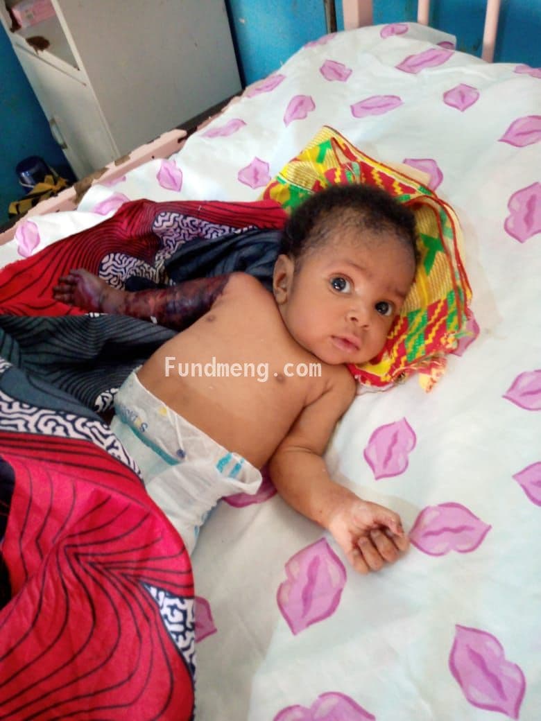 Save Baby Miracle's Hand