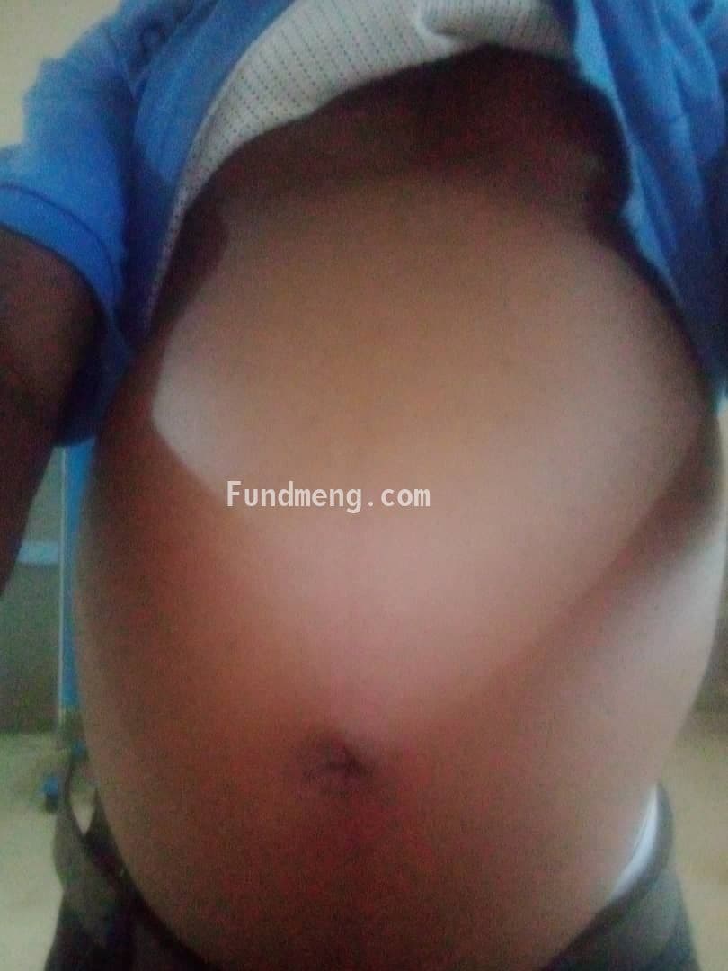 Help Ayodele Ologunmeta get a kidney transplant