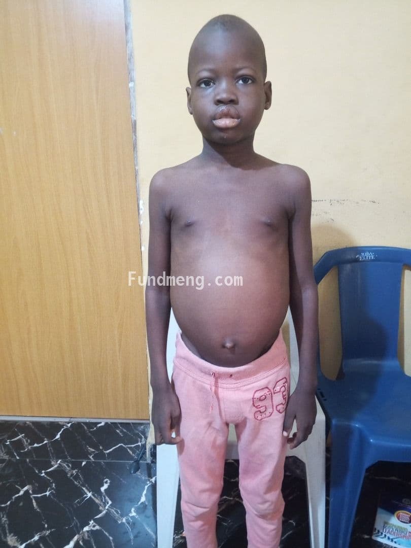 HELP PAUL OLUYEMI BEAT CANCER OF THE BLOOD LUEKEMIA