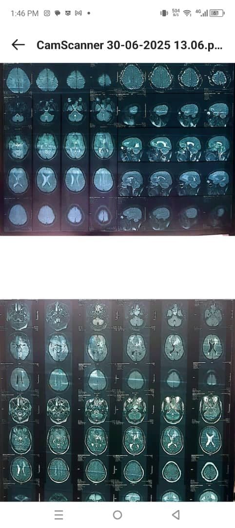 Urgent Medical Support for My Father's Brain Surgery