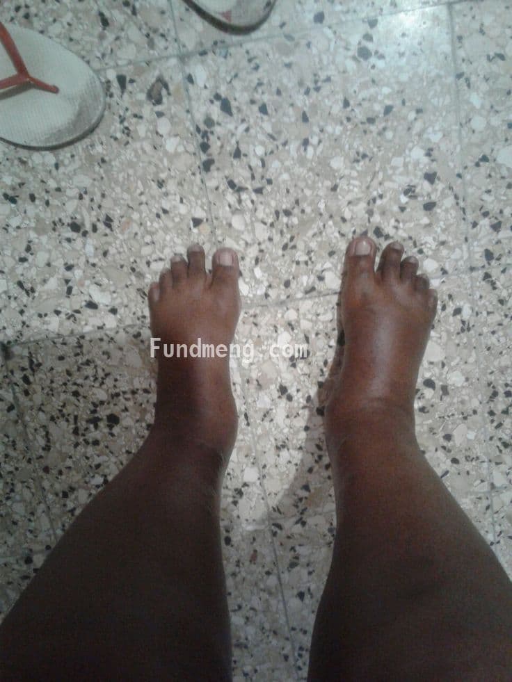 Please help Mr. Raphael Akwaobi so he can afford to treat his malnutrition