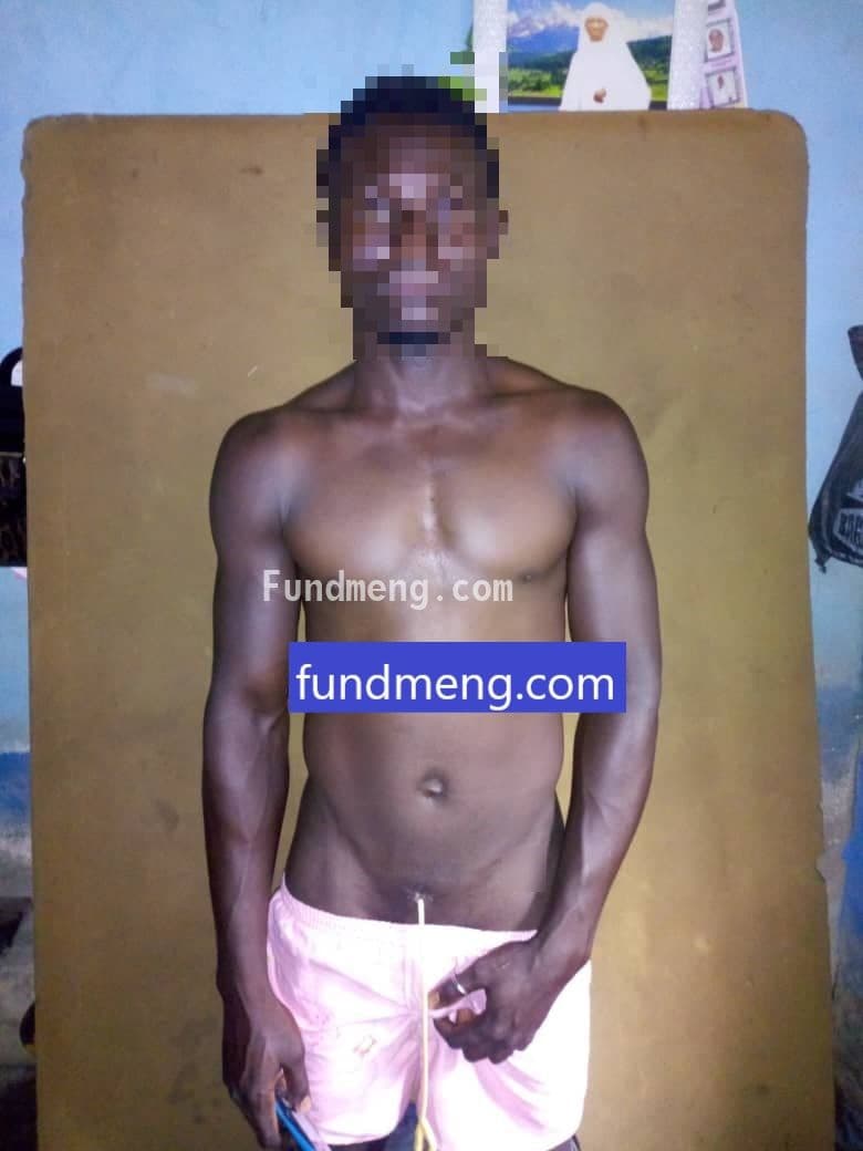 Help Emmanuel use his penis again