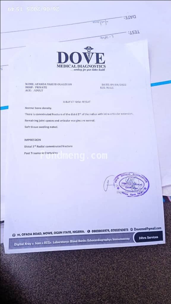 Help Registered Nurse Atanda manage his Spinal cord health and manage his fractured left wristchallenges